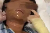 悚！陸美女主播家門口取包裹　竟是「包裹炸彈」慘炸毀容