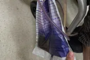 尿袋變紫色非吃錯藥！醫：移除導尿管才能有效控制感染