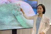 藥物過敏後遺症驚人！研究：罹紅斑性狼瘡機率高近15倍