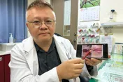 她臉部遭愛犬撕裂4公分險毀容　靠「PRP療法」修復