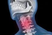 天天運動男「喉嚨痛」一查竟罹4種癌！醫曝菸酒檳榔釀禍
