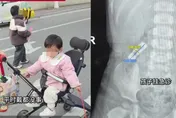 陸一歲女童誤食3公分髮夾　成功靠吃韭菜排出