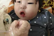 女嬰手術後成植物人「醫院不回覆、檢方怪早產」 母泣訴：如小蝦米只能被欺壓！