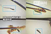陸女愛化「精緻眼妝」但懶得卸！眼睛奇癢竟藏「6條蟎蟲」嚇傻
