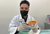 糖尿病併發青光眼險失明！新型「保羅導管」助重見光明