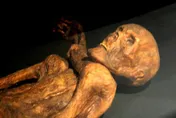 5300年前木乃伊就有性病？「冰人奧茲」驗出HPV致癌病毒