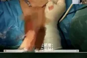 5萬人在線看！陸醫院婦科手術直播曝女病患「下體私密處」惹議