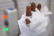 慘！陸女左手被50噸沖床「壓成肉泥」　醫12小時手術撿回命