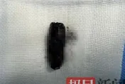 陸男鼻子狂流膿飄異味　檢查驚揭「3公分螺絲藏鼻腔」40年