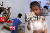 家長注意！陸男童好奇玩「滅火毯」　全身被扎滿超細玻璃纖維
