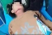 恐怖血滴子！陸少年騎車突被繩索「割喉」　「一段氣管」不見了