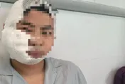 驚悚！陸男海洋館下水體驗遭「3米巨鯊撕咬」　頭皮掉落滿臉血