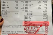 喵星人咬一口！飼主慘染噬肉菌險喪命　醫藥費狂噴50萬元
