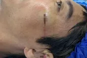 王力宏演唱會「摔下濺血重創」縫39針！親自說明狀況了