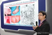 台灣自製腸病毒疫苗打入國際　搶下越南、澳門藥證