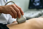 免費腹部超音波揪出9成異常！全台31院所同步開放檢查