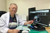 肚子劇痛送醫…腹腔全是血？56歲婦肝癌破裂休克險喪命