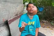 泰男牙籤剔牙「左臉長出巨大腫瘤」 求助遭酸AI造假