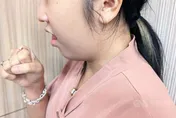 紓解公費肺癌篩檢瓶頸　彰基一站式服務提高量能