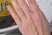 中職/大巨蛋搶界外球衝突球迷手指受傷　聯盟暖心補送1棒球
