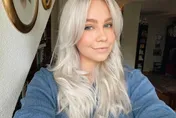 打麻藥秒昏迷　芬蘭27歲網紅抽脂手術台上身亡