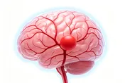 「腦動脈瘤破裂」前多半沒症狀！突發劇烈頭痛快就醫