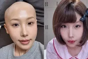 甜美網紅「胃癌過世」得年25歲！曾反省患病前「常熬夜常喝奶茶」