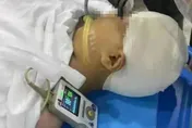 9歲女童遭男師打破頭骨「腦漿流出」　甦醒駁誤傷說法：故意打了2次