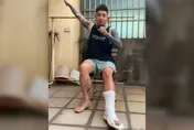跳科目三跳到骨折成「全台第一人」！　網笑：可以掛號骨科三