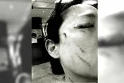 提醒戴口罩遭「挖眼砍傷」輕判8個月　苦主怒上訴：再死人才會被重視？