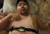 統神哥哥曬「插管照」嚇壞粉絲！他曝病重嘆：呼吸停止45次