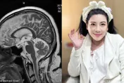 陳文茜秀「腦部MRI影像」曝病況　嘆：去年此時癌細胞激增！