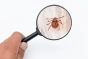 今年首例！北部60歲婦人確診萊姆病　皮膚紅癢、血尿急就醫