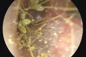 驚！陸1歲童狂抓耳就診曝恐怖景象　耳道內「長出小嫩芽」