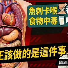 魚刺卡喉喝醋吞白飯? 誤食中毒物 喝牛奶?專家說都沒用 要立刻送醫!【#小麥的健康筆記】@中天電視CtiTv  ‪@健康我加1CtiHealthyme