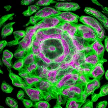 同基因有人罹癌有人沒事！醫：身體「代謝環境」是關鍵