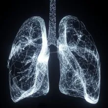 沒咳嗽不代表沒事！「具家族史、老菸槍」快去照LDCT