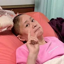 王月跌倒撞頭！緊急開顱手術昏迷5天　部分頭蓋骨遭移除