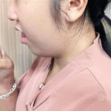 紓解公費肺癌篩檢瓶頸　彰基一站式服務提高量能