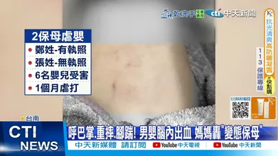 【每日必看】托嬰中心違法超收! 惡保母涉虐6嬰"打到腦出血" 20251228