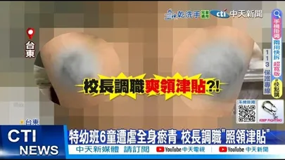 【每日必看】特幼班6童遭虐全身瘀青 校長調職”照領津貼” 20251119