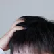 阿伯頭皮痘痘擦藥沒好竟是「胃癌末期」　醫曝「5警訊」！