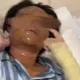 悚！陸美女主播家門口取包裹　竟是「包裹炸彈」慘炸毀容