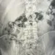 影/2波蘭男吞百顆海洛因入腹　闖關遭逮急送醫排出