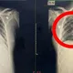小感冒險喪命！18歲女學生罹雷米爾氏症　醫：致命感染只需數小時