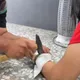 影/車禍手腫脹玉鐲陷皮肉　消防鐵槌一敲化解危機
