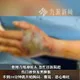 斷頭竟「跳起來咬人」！陸7旬翁斬眼鏡蛇頭遭咬　左手發黑險沒命
