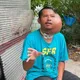 泰男牙籤剔牙「左臉長出巨大腫瘤」 求助遭酸AI造假