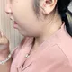 紓解公費肺癌篩檢瓶頸　彰基一站式服務提高量能