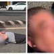 行車糾紛老翁倒地「一張圖看出嚴重度」　醫：雙手姿勢是關鍵